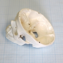 Макет черепа A20  Вид 5