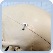 Макет черепа A20  Вид 16