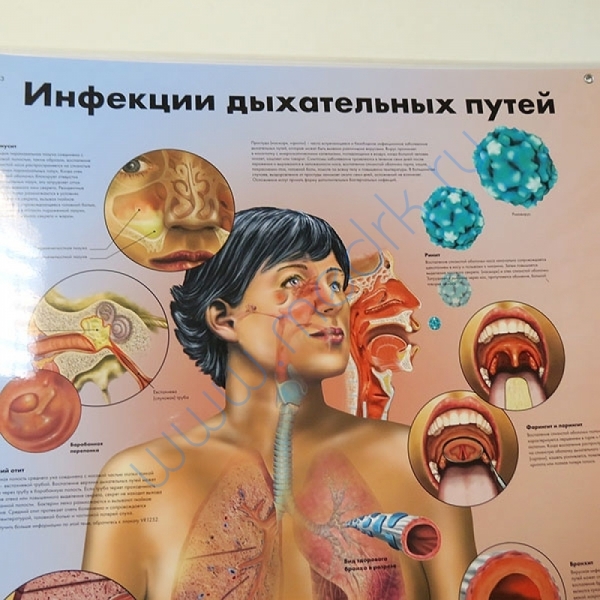 Плакат Инфекции дыхательных путей ламинированный, 3B Scientific  Вид 2