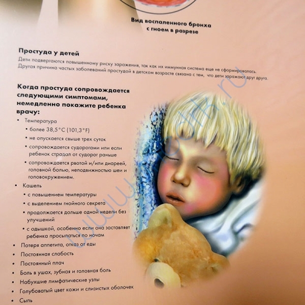 Плакат Инфекции дыхательных путей ламинированный, 3B Scientific  Вид 4