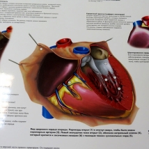Плакат Распространенные сердечные заболевания ламинированный  Вид 1