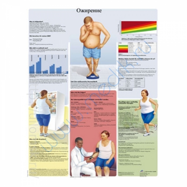 Плакат медицинский Ожирение ламинированный русифицированный   Вид 1