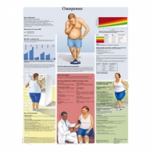 Плакат медицинский Ожирение ламинированный русифицированный  
