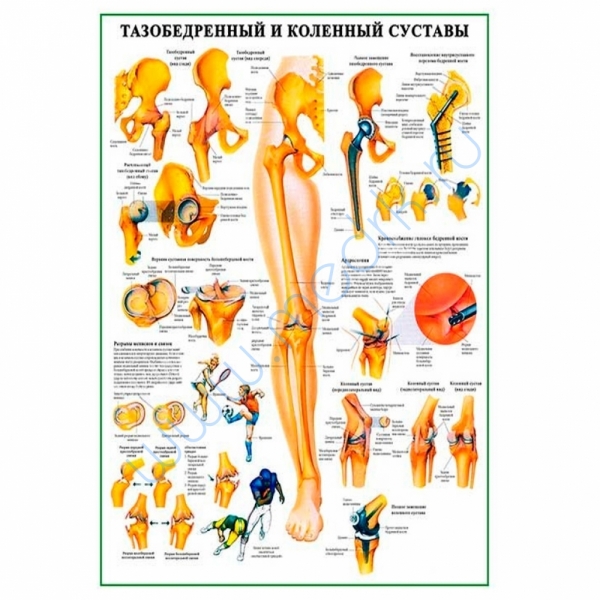 Тазобедренный и коленный суставы — медицинский плакат  Вид 1