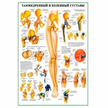Тазобедренный и коленный суставы — медицинский плакат